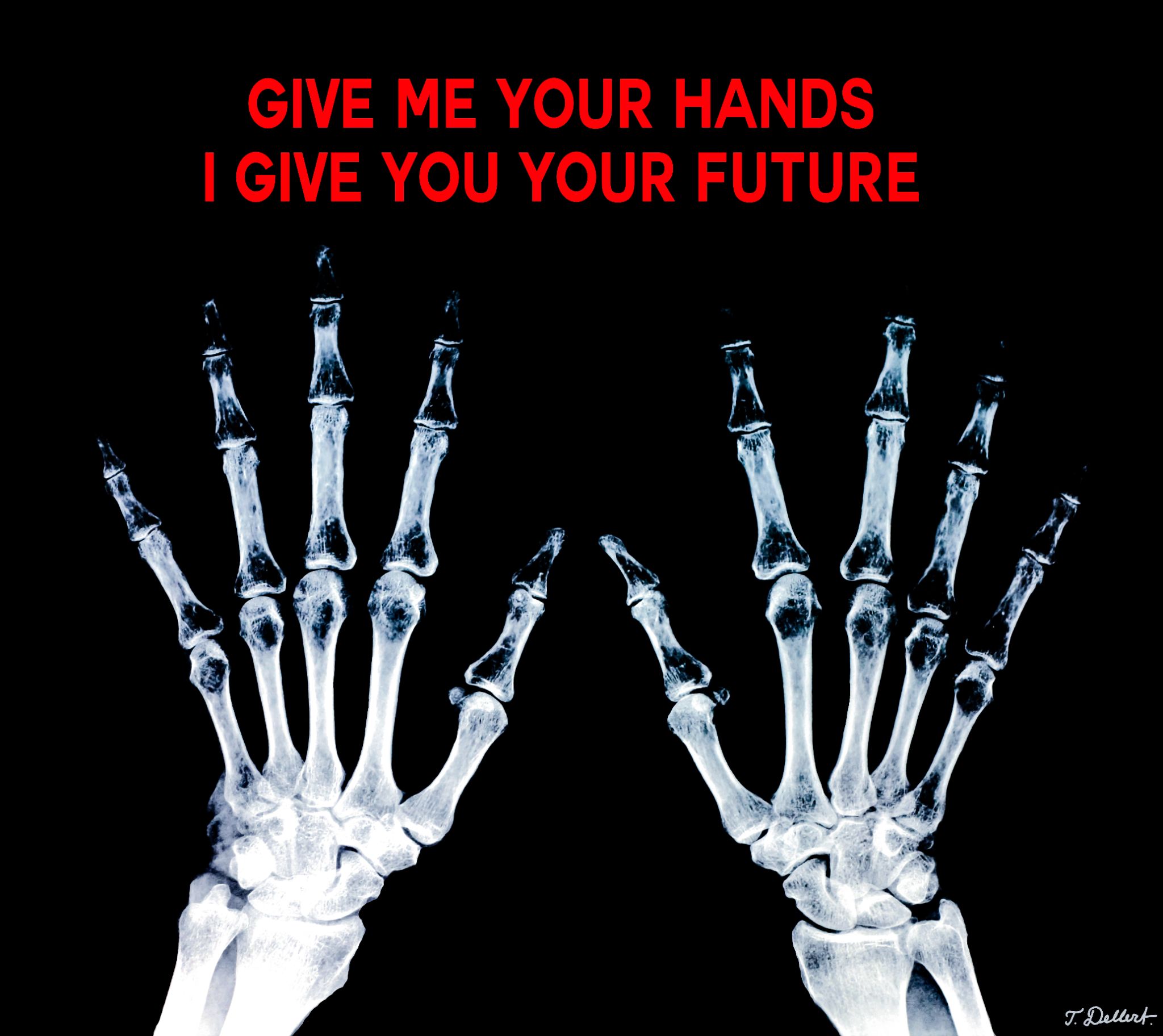Hands X-ray